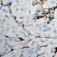 19 - Anti-Collagen 18 alpha 1 Antibody AP53893