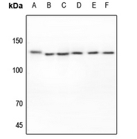 1 - Anti-EPHA2 Antibody AP53895