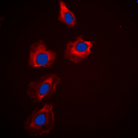 3 - Anti-PAK1/2/3 Antibody AP53896