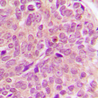 19 - Anti-PAK1/2/3 Antibody AP53896