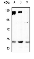 1 - Anti-SNAT2 Antibody AP53898