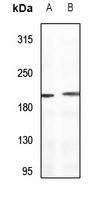 1 - Anti-Sugen Kinase 269 Antibody AP53906