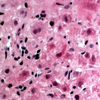 19 - Anti-Glycerol Kinase 1 Antibody AP53911