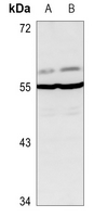 1 - Anti-Glycerate Kinase Antibody AP53912