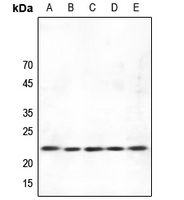1 - Anti-ASF1B Antibody AP53915