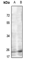 1 - Anti-MRPL22 Antibody AP53916