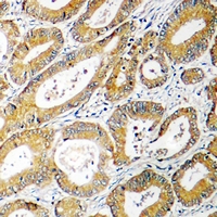 19 - Anti-AGXT2L2 Antibody AP53917