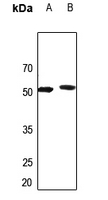 1 - Anti-AGXT2L2 Antibody AP53917