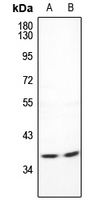 1 - Anti-CDC42EP4 Antibody AP53918