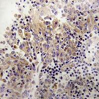 19 - Anti-PRKY Antibody AP53922