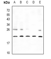 1 - Anti-CPI17 Antibody AP53927