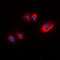 3 - Anti-HSP20 (Phospho-S16) Antibody AP53928