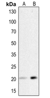 1 - Anti-HSP20 (Phospho-S16) Antibody AP53928