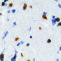19 - Anti-SRSF5 Antibody AP53930