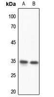 1 - Anti-HOXD13 Antibody AP53933