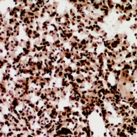 19 - Anti-ZNF600 Antibody AP53935