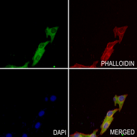 3 - Anti-SETMAR Antibody AP53938