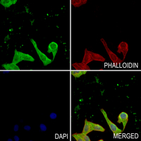 3 - Anti-Alpha-taxilin Antibody AP53940