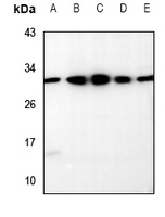 1 - Anti-RRP7A/B Antibody AP53942