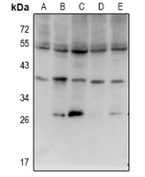 1 - Anti-ISG20L2 Antibody AP53943