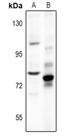 1 - Anti-Chromogranin B Antibody AP53944