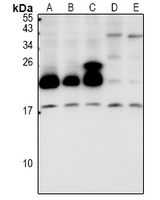 1 - Anti-Cytochrome b5B Antibody AP53946