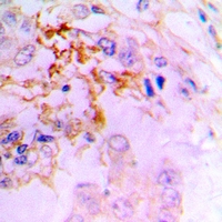 19 - Anti-CCL5 Antibody AP53947