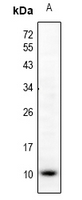 1 - Anti-CCL5 Antibody AP53947