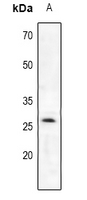 1 - Anti-Trypsin 2 Antibody AP53948