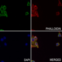 3 - Anti-TIG1 Antibody AP53949