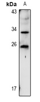 1 - Anti-TIG1 Antibody AP53949