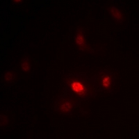 3 - Anti-ZNF392 Antibody AP53950