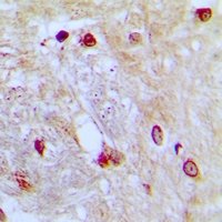 19 - Anti-ZNF392 Antibody AP53950