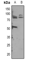 1 - Anti-ADAM12-S Antibody AP53952