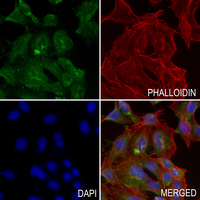 3 - Anti-ADAM12-L Antibody AP53953