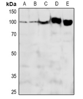 1 - Anti-ADAM12-L Antibody AP53953