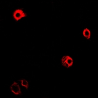 3 - Anti-GPRC5D Antibody AP53954