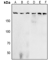 1 - Anti-Acinus (Phospho-S1180) Antibody AP53960