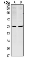 1 - Anti-CCDC102A Antibody AP53962