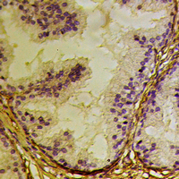 19 - Anti-Connexin 31.3 Antibody AP53964