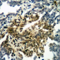 19 - Anti-RANBP17 Antibody AP53973