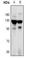 1 - Anti-RANBP17 Antibody AP53973