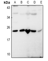 1 - Anti-RASL10B Antibody AP53975
