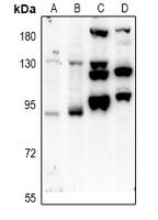 1 - Anti-PTPN22 Antibody AP53984