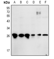 1 - Anti-ZNF575 Antibody AP53986