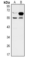 1 - Anti-ZNF446 Antibody AP53987