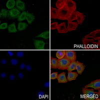 3 - Anti-Cytochrome P450 11B1/2 Antibody AP53988