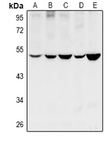 1 - Anti-Cytochrome P450 11B1/2 Antibody AP53988