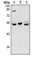 1 - Anti-HNF4 alpha/gamma Antibody AP53989