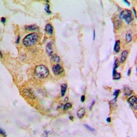 19 - Anti-Cytochrome P450 4V2 Antibody AP53990